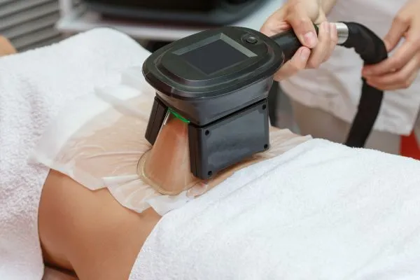 Image of person having fat freezing treatment to help weight gain Welwyn Garden City