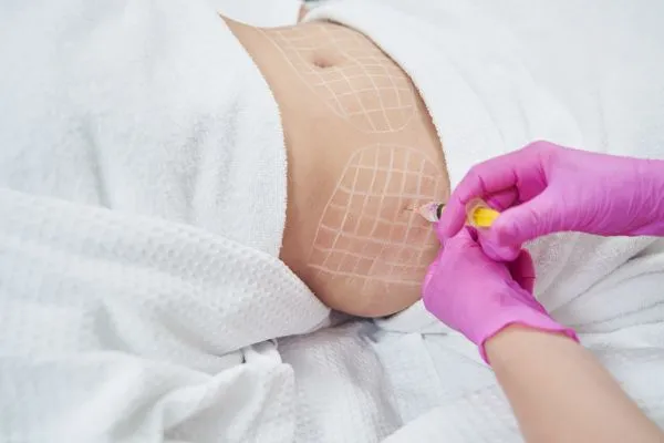 image of fat dissolving injections on love handles to help combat weight gain Welwyn Garden City