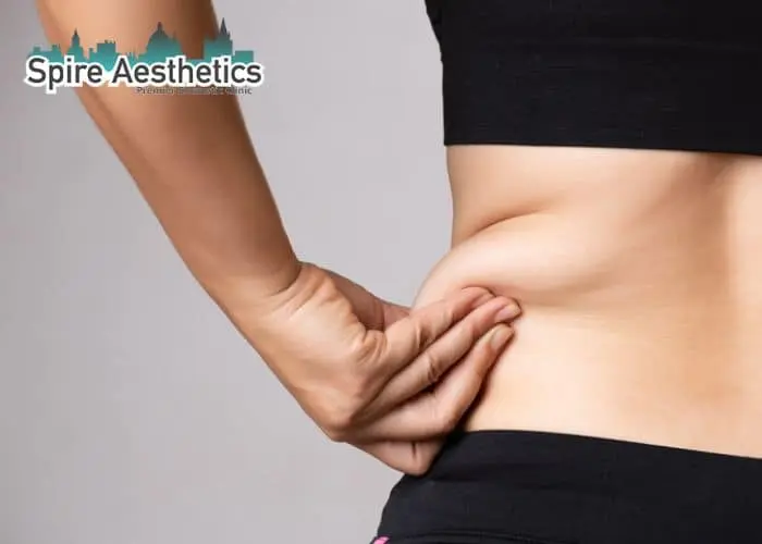 Image of woman pinching fat on their hips Welwyn Garden City. Fat Freezing treatment